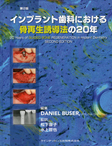 インプラント歯科における骨再生誘導法の20年 [本]